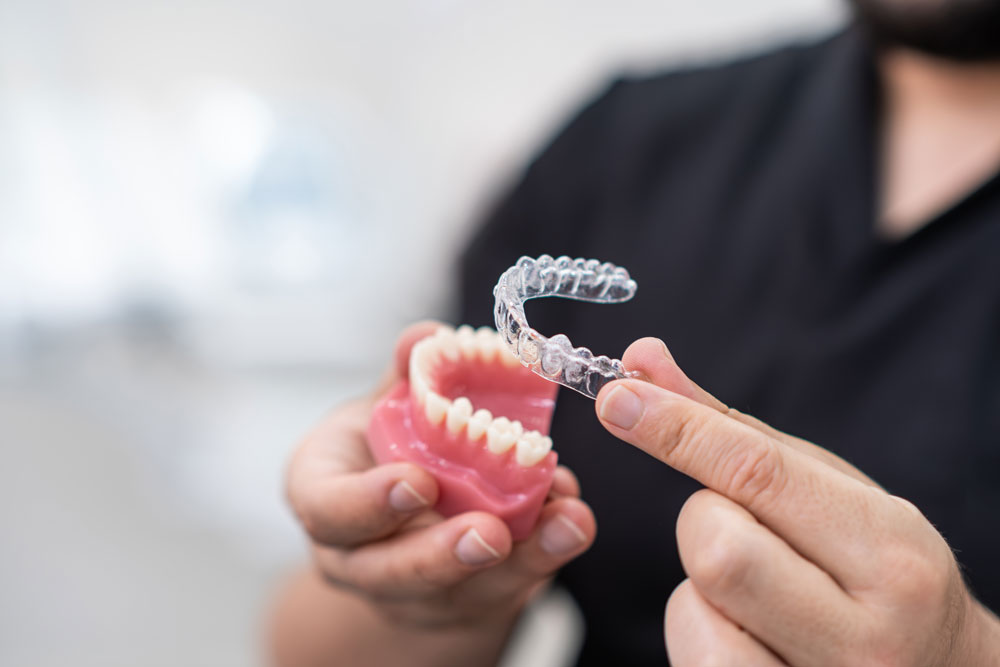 Invisalign / Clear Aligners